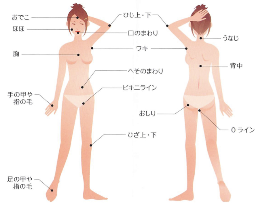 脱毛部位